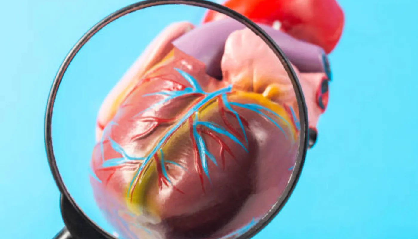 Perikarditis uzroci i liječenje za pravovremenu dijagnozu i zaštitu srca